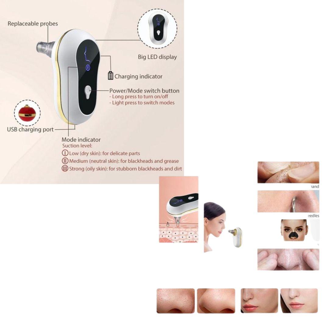 EXTRACTOR DE PUNTOS NEGROS